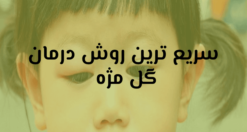 گل مژه
