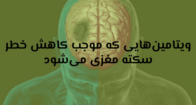 سکته مغزی