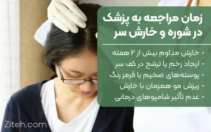 زمان مراجعه به پزشک در شوره و خارش سر