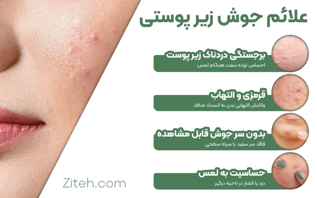علائم جوش زیر پوستی